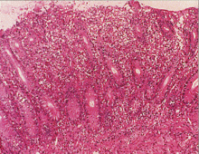 ��ᇐ��咰���@�g�D��