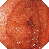 ��ᇐ��咰���@�y��