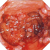 ��ᇐ��咰���@���x